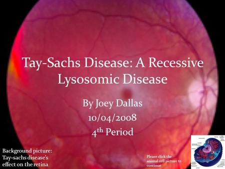 Tay-Sachs Disease: A Recessive Lysosomic Disease