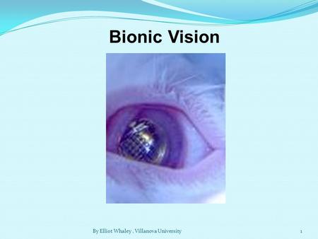 Bionic Vision 1By Elliot Whaley, Villanova University.