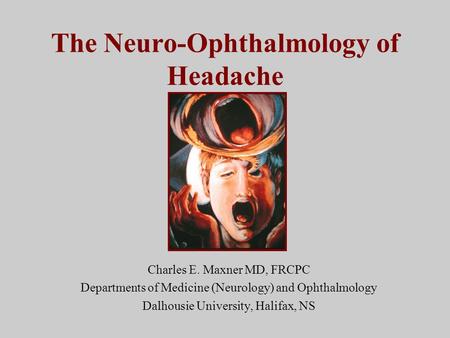 The Neuro-Ophthalmology of Headache