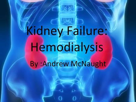 Kidney Failure: Hemodialysis By :Andrew McNaught.