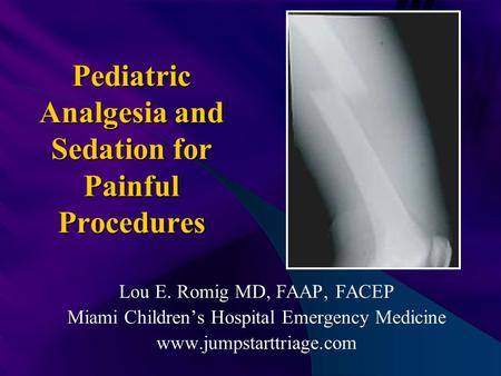 Pediatric Analgesia and Sedation for Painful Procedures