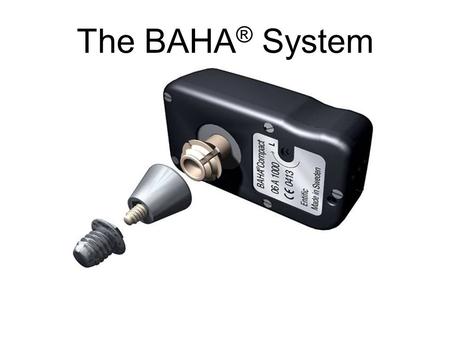 The BAHA ® System. Types of hearing loss the BAHA ® System can help Unilateral sensori-neural hearing loss/Single Sided Deafness –Due to examples.