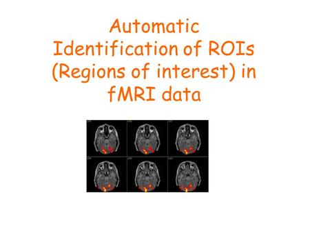 Automatic Identification of ROIs (Regions of interest) in fMRI data.