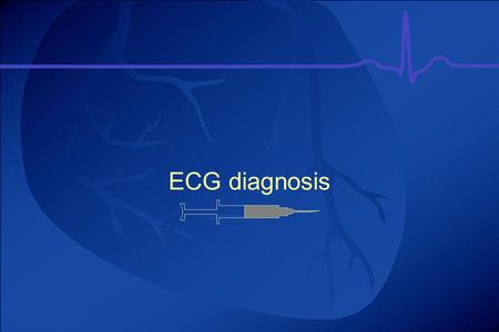 ECG diagnosis.