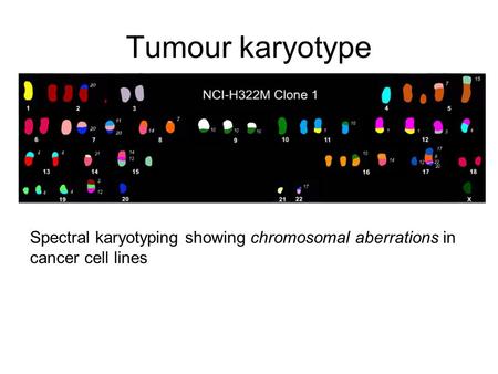 Tumour karyotype Spectral karyotyping showing chromosomal aberrations in cancer cell lines.