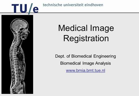 Medical Image Registration Dept. of Biomedical Engineering Biomedical Image Analysis www.bmia.bmt.tue.nl.