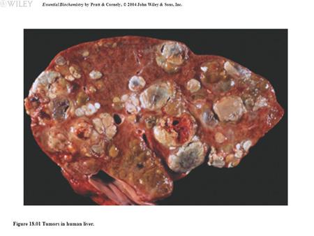 Essential Biochemistry by Pratt & Cornely, © 2004 John Wiley & Sons, Inc. Figure 18.01 Tumors in human liver.