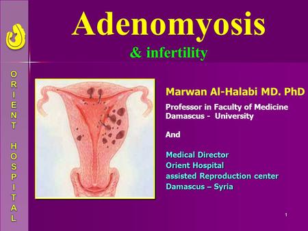 Adenomyosis & infertility Marwan Al-Halabi MD. PhD