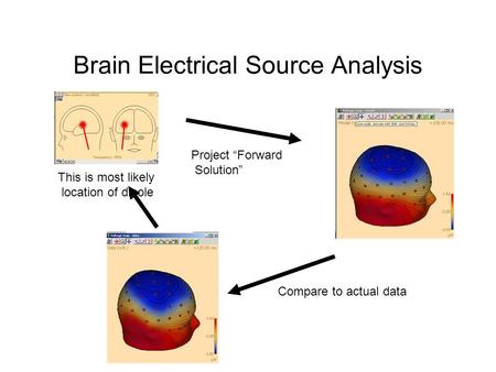 Brain Electrical Source Analysis This is most likely location of dipole Project “Forward Solution” Compare to actual data.