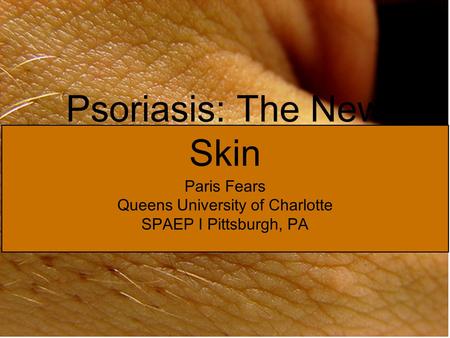 Psoriasis: The New Skin Paris Fears Queens University of Charlotte SPAEP I Pittsburgh, PA.
