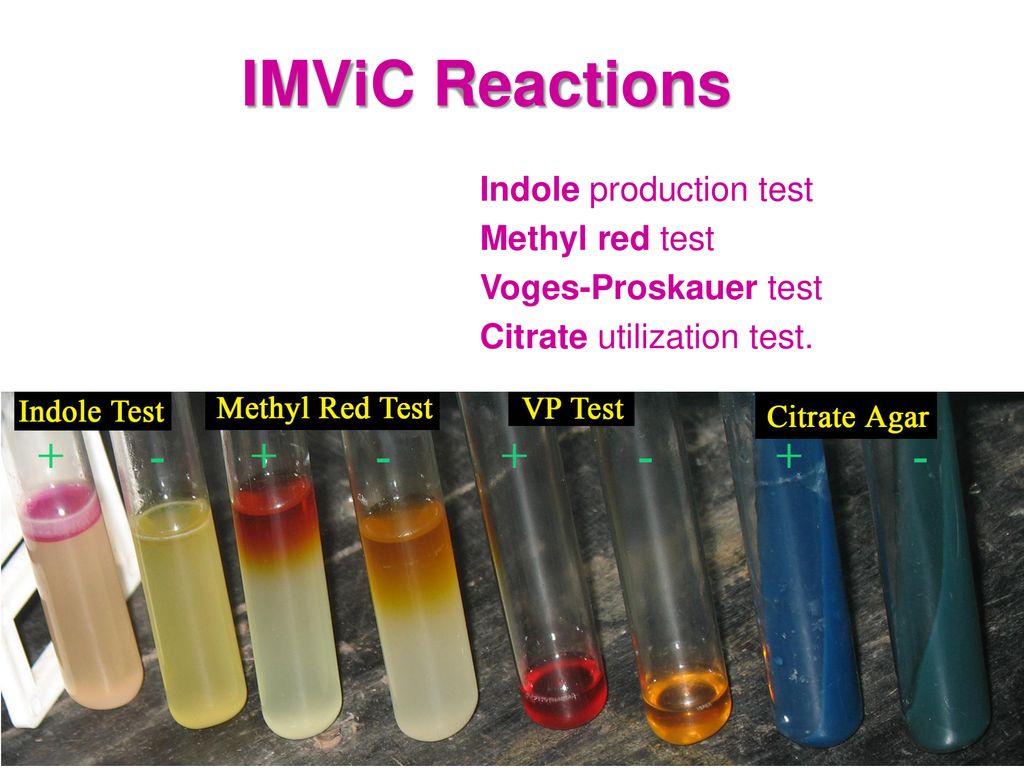 IMViC Reactions Indole production test Methyl red test - ppt download