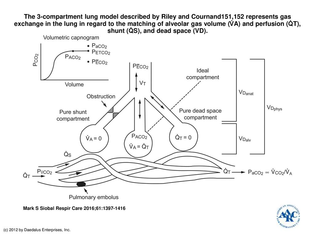 Schematic representation of Riley's threecompartment lung model