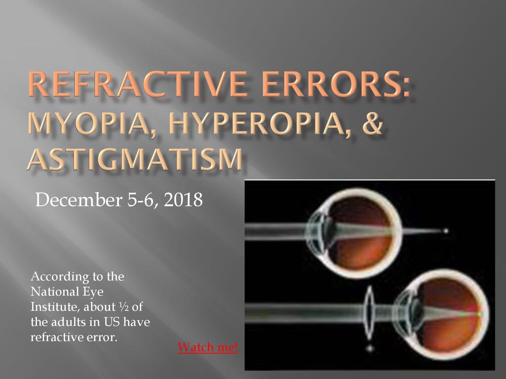 myopia hyperopia astigmatism és kezelésük