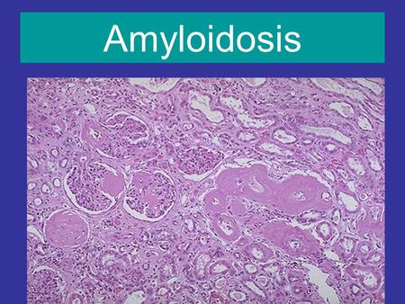 Amyloidosis 1.