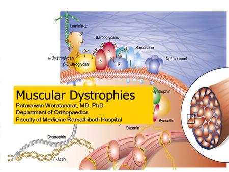 Muscular Dystrophies Patarawan Woratanarat, MD, PhD Department of Orthopaedics Faculty of Medicine Ramathibodi Hospital.