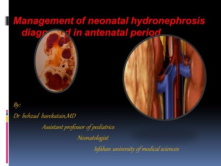 Management of neonatal hydronephrosis diagnosed in antenatal period