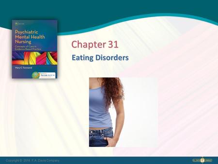 Copyright © 2014. F.A. Davis Company Eating Disorders Eating Disorders Chapter 31.