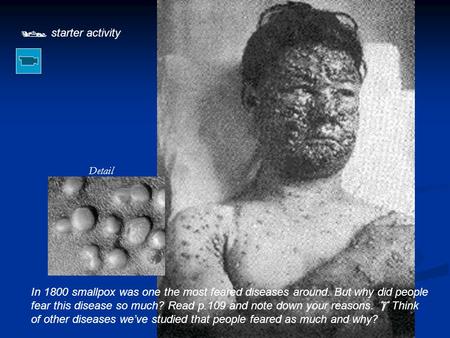  starter activity Detail In 1800 smallpox was one the most feared diseases around. But why did people fear this disease so much? Read p.109 and note down.