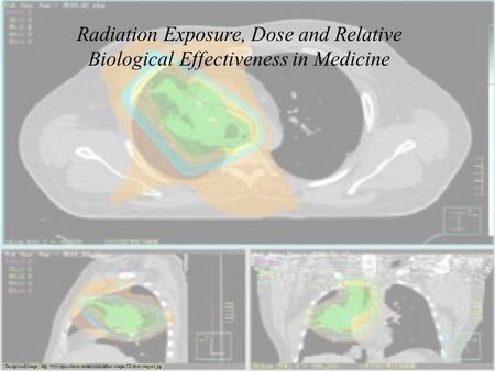 Radiation Exposure, Dose and Relative Biological Effectiveness in Medicine Background Image: http://www.upmccancercenters.com/radonc/images/3D-dose-cropped.jpg.