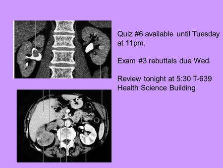 Quiz #6 available until Tuesday at 11pm. Exam #3 rebuttals due Wed. Review tonight at 5:30 T-639 Health Science Building.