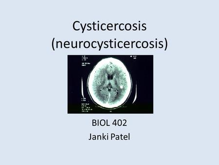 Cysticercosis (neurocysticercosis) BIOL 402 Janki Patel.