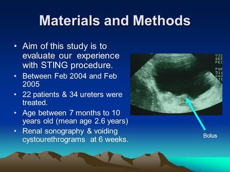 Materials and Methods Aim of this study is to evaluate our experience with STING procedure. Between Feb 2004 and Feb 2005 22 patients & 34 ureters were.