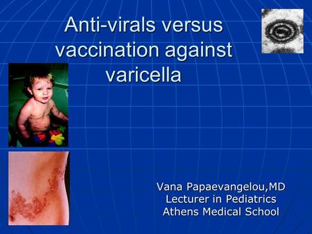 Anti-virals versus vaccination against varicella Vana Papaevangelou,MD Lecturer in Pediatrics Athens Medical School.