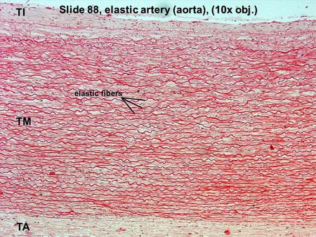 Slide 88, elastic artery (aorta), (10x obj.) TI TM TA elastic fibers.