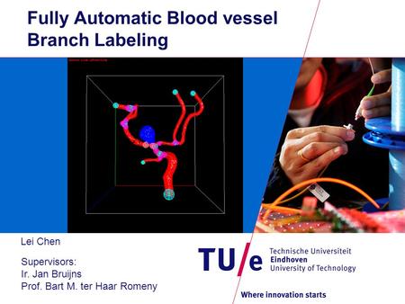 Fully Automatic Blood vessel Branch Labeling Lei Chen Supervisors: Ir. Jan Bruijns Prof. Bart M. ter Haar Romeny.