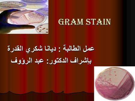 Gram stain عمل الطالبة : ديانا شكري القدرة بإشراف الدكتور: عبد الرؤوف.