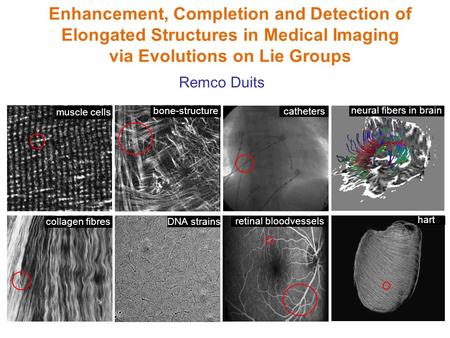 Enhancement, Completion and Detection of Elongated Structures in Medical Imaging via Evolutions on Lie Groups muscle cells bone-structure retinal bloodvessels.