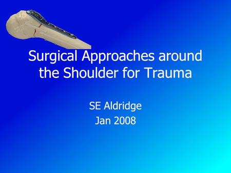 Surgical Approaches around the Shoulder for Trauma SE Aldridge Jan 2008 SE Aldridge Jan 2008.