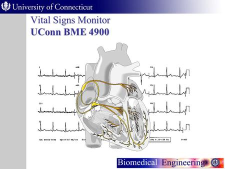 Vital Signs Monitor UConn BME 4900 Vital Signs Monitor Purpose As the population ages, many people are required by their doctors to take vital signs.