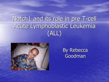 Notch1 and its role in pre T-cell Acute Lymphoblastic Leukemia (ALL) By Rebecca Goodman.