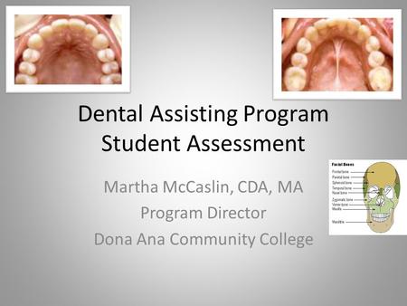 Dental Assisting Program Student Assessment Martha McCaslin, CDA, MA Program Director Dona Ana Community College.