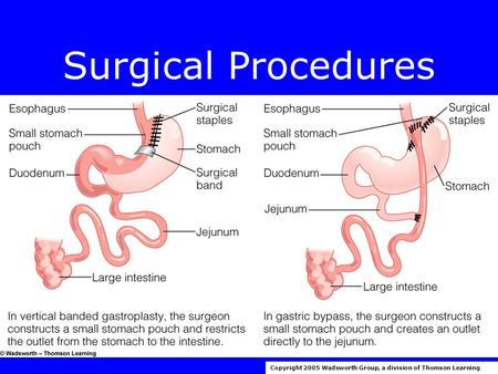 Surgical Procedures Copyright 2005 Wadsworth Group, a division of Thomson Learning.