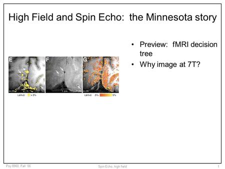 Psy 8960, Fall ‘06 Spin Echo, high field1 High Field and Spin Echo: the Minnesota story Preview: fMRI decision tree Why image at 7T?