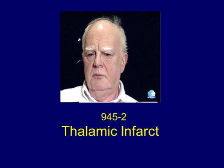 945-2 Thalamic Infarct. Neuroimaging Figure 1. Right medial thalamic infarct.