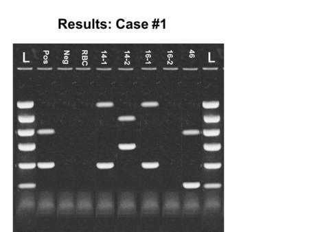 Results: Case #1 25B 25C 46 PosNeg RBC 14-114-2 16-1 16-2.