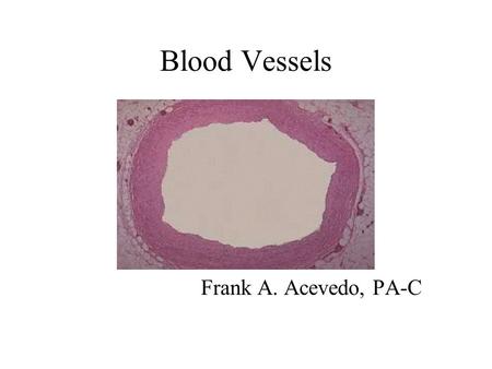 Blood Vessels Frank A. Acevedo, PA-C. Vascular Abnormalities Narrowing of the lumen Thrombosis Weakening of the walls.