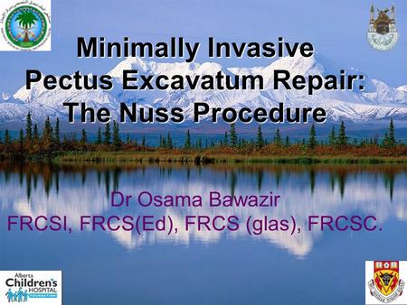 Minimally Invasive Pectus Excavatum Repair: The Nuss Procedure