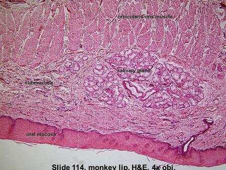 Slide 114, monkey lip, H&E, 4x obj. oral mucosa submucosa salivary gland orbicularis oris muscle.