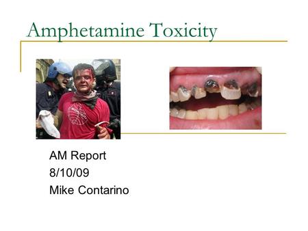 Amphetamine Toxicity AM Report 8/10/09 Mike Contarino.
