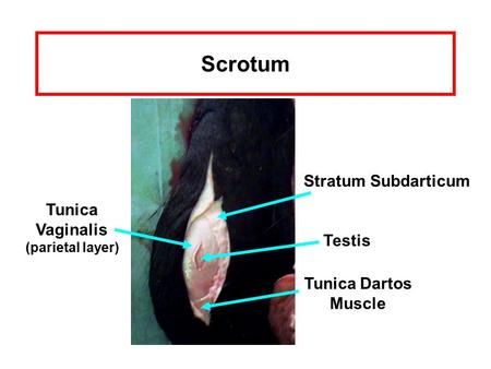 Scrotum Stratum Subdarticum Tunica Vaginalis Testis Tunica Dartos