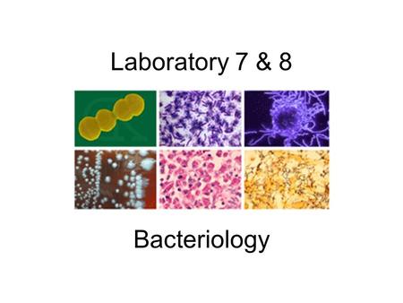 Laboratory 7 & 8 Bacteriology. Bacteria Small Unicellular Organisms Can be grown in nutrient enriched environments (Agar, Broth) Standard Medias: Tryptic.