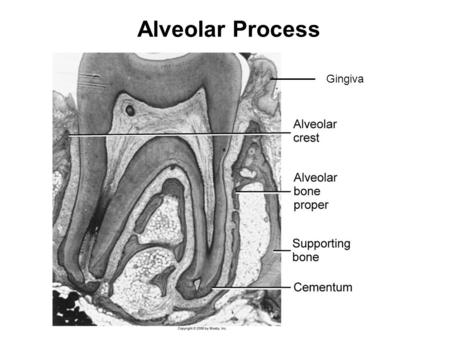 Alveolar Process Gingiva.