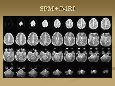 SPM+fMRI. K space K Space Mechanism of BOLD Functional MRI Brain activity Oxygen consumptionCerebral blood flow Oxyhemoglobin Deoxyhemoglobin Magnetic.
