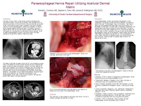 Paraesophageal Hernia Repair Utilizing Acellular Dermal Matrix University of South Carolina Department of Surgery Randal L. Croshaw, MD, Stephen A. Fann,