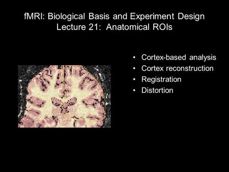 FMRI: Biological Basis and Experiment Design Lecture 21: Anatomical ROIs Cortex-based analysis Cortex reconstruction Registration Distortion 1 light year.