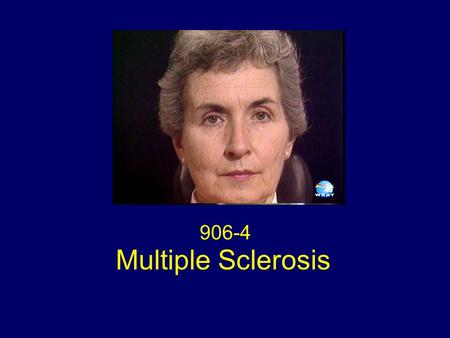 Multiple Sclerosis 906-4. Eye Movements Transient spontaneous primary position upbeat nystagmus with lid nystagmus Rapid bursts of horizontal square wave.